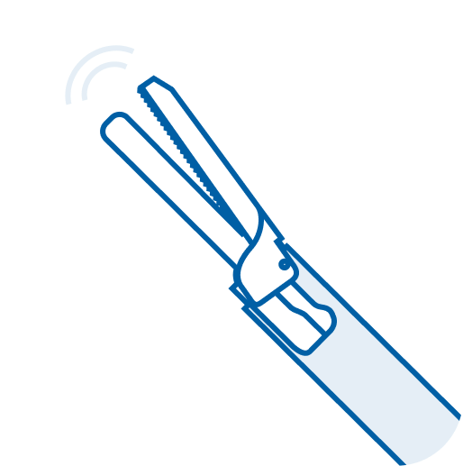 Extended Ultrasonic Scalpel